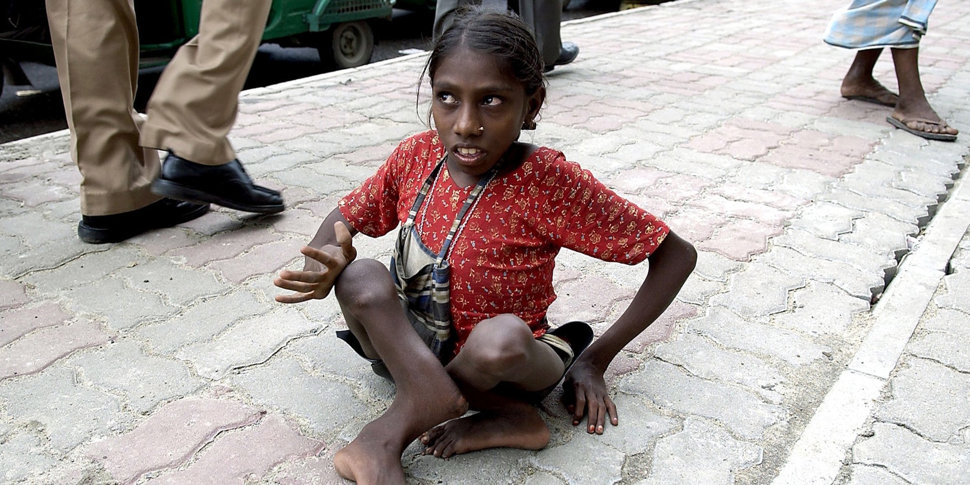 A Bangladeshi child with a physical disability sits on the ground.